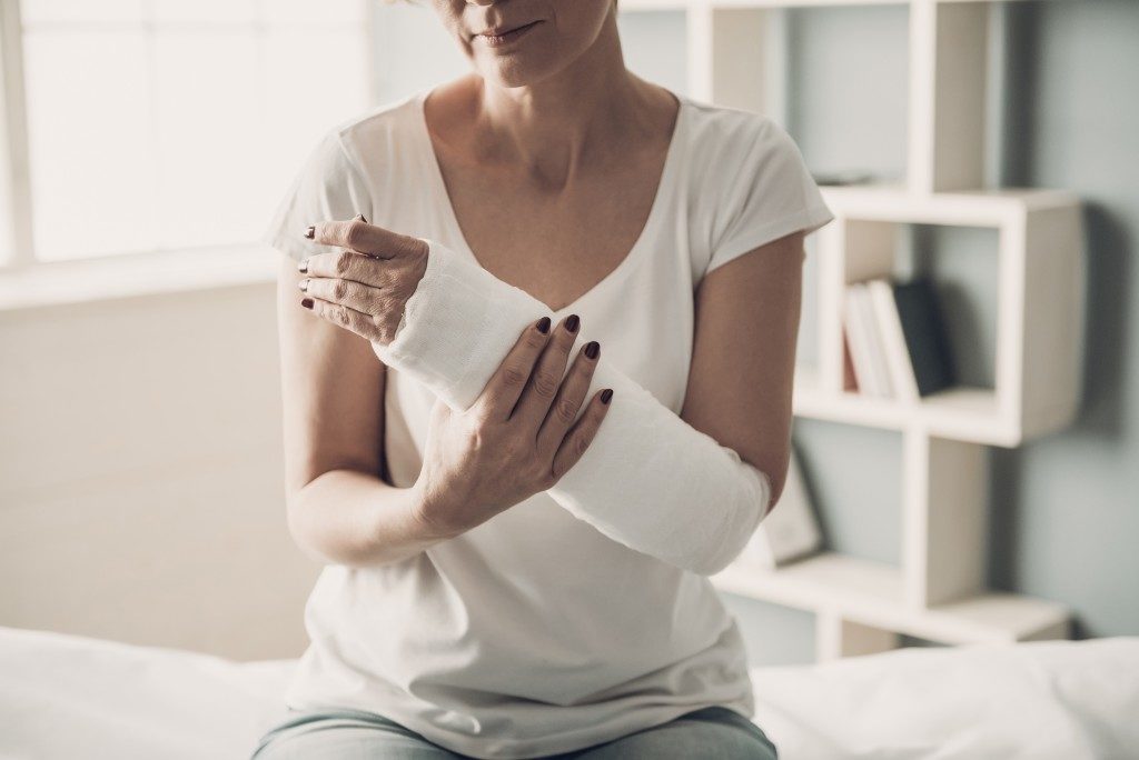 Injured woman with arm cast